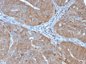 AKR1B1 Antibody / Aldose reductase