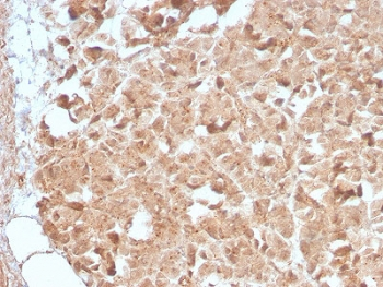 CELA3B Antibody / Elastase 3B