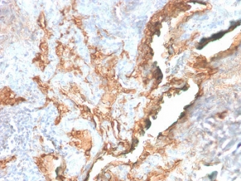Tenascin C Antibody
