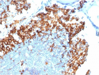 IL3RA Antibody / CD123