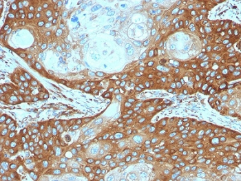 RPSA Antibody / 40S Ribosomal protein SA