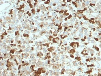 NGF Receptor Antibody / p75NTR / CD271