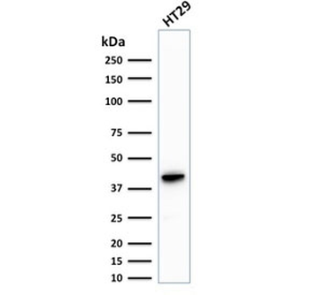Cytokeratin 20 Antibody / CK20