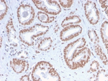 ATRX Antibody / RAD54