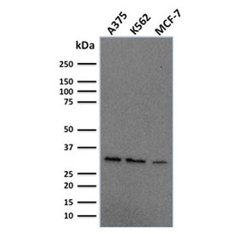 RPA32 Antibody / Replication Protein A2