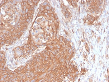 SPTBN2 Antibody / Spectrin beta III