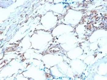 Calbindin 2 Antibody / CALB2 / Calretinin