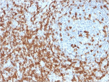 CD5 Antibody