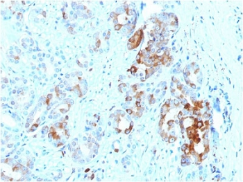 FTL Antibody / Ferritin light chain