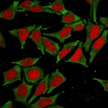 GSTM2 Antibody / Glutathione S-Transferase mu 2