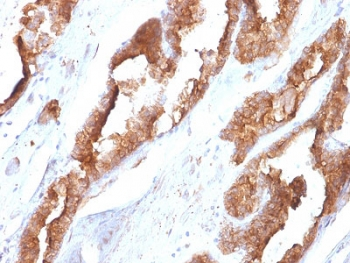 HSP27 Antibody / HSPB1
