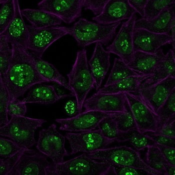 Ki67 Antibody