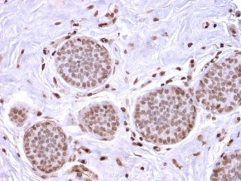 Mammaglobin A Antibody / SCGB2A2