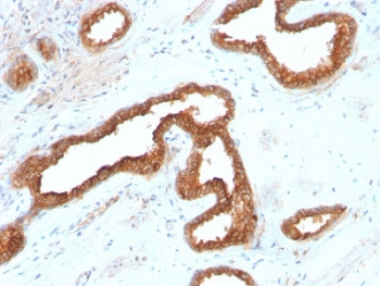 AMACR / p504S Antibody (Prostate Cancer Marker)