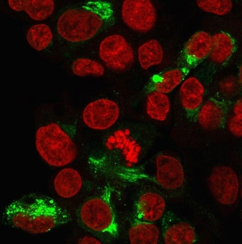 Albumin Antibody / ALB