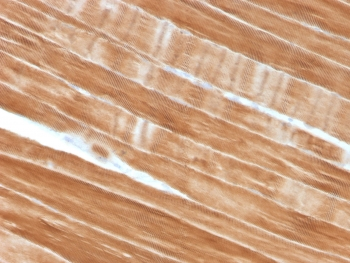 ACTN2 Antibody / Alpha Actinin 2 / Sarcomeric Alpha Actinin