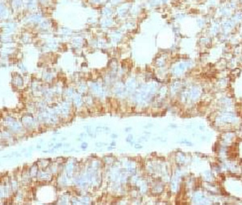 ICOS-L Antibody / ICOS Ligand / B7RP-1