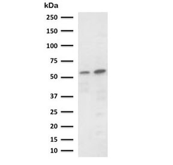 PD-L2 Antibody / Programmed death ligand 2 / CD273