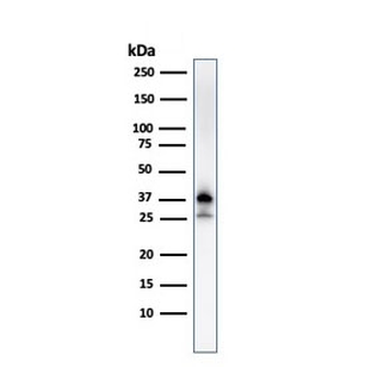 Nucleophosmin Antibody / NPM1