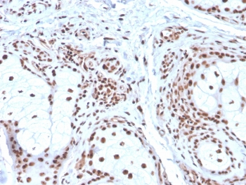 Nucleophosmin Antibody / NPM1