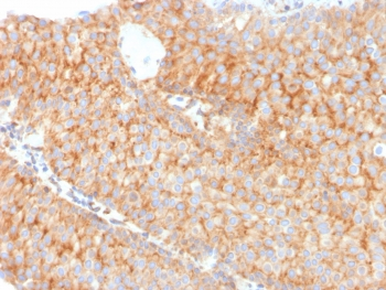 SERBP1 Antibody / PAI-RBP1