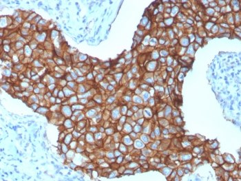 HER2 Antibody / ErbB2
