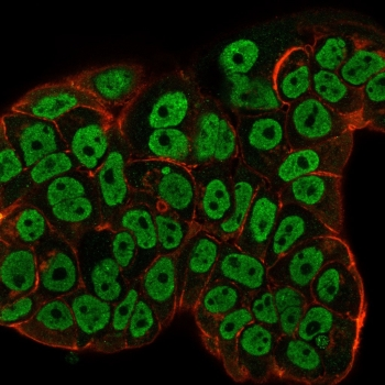 Estrogen Receptor alpha Antibody