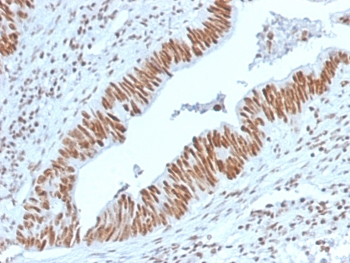Nucleophosmin Antibody / NPM1