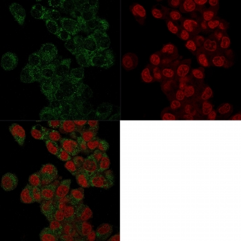 Prohibitin Antibody / PHB