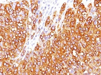 MART-1 / Melan-A Antibody