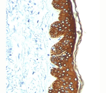 Basic Cytokeratin Antibody (HMW / Type II)