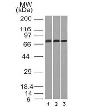 CD105 Antibody / Endoglin