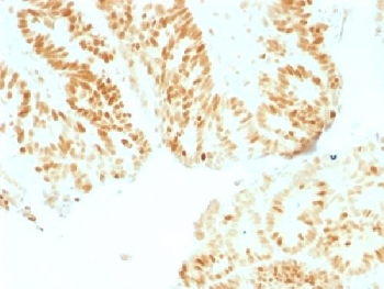 Retinoblastoma Antibody / Rb1