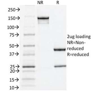 Estrogen Receptor alpha Antibody