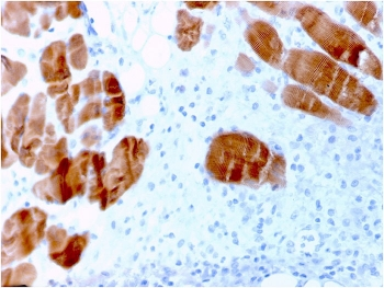 ACTN2 Antibody / Alpha Actinin 2 / Sarcomeric Alpha Actinin