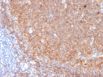 CD19 Antibody / B-lymphocyte marker