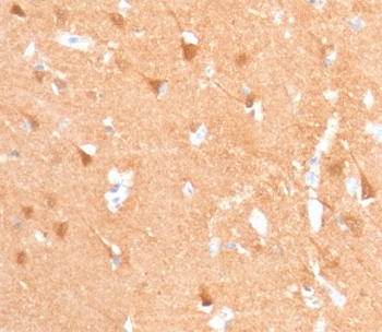 PGP9.5 / UchL1 Antibody