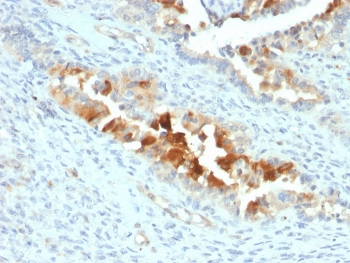 Mesothelin Antibody / MSLN