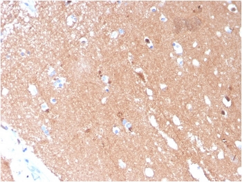 Beta Tubulin Antibody / TUBB3