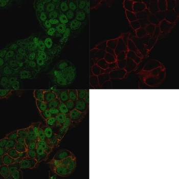 CHD4 Antibody / Chromodomain helicase DNA binding protein 4