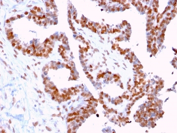 DMC1 Antibody