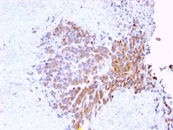 TOP1MT Antibody / Topoisomerase I mitochondrial