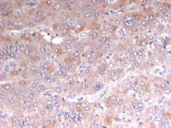 Adipophilin Antibody / Perilipin 2 / ADRP / PLIN2