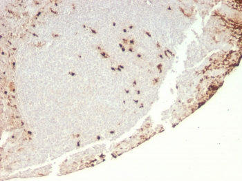 CSF3 Antibody / Granulocyte-Colony Stimulating Factor