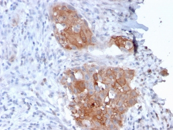 Desmoglein 1 Antibody / DSG1