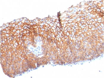 Desmoglein 3 Antibody / DSG3