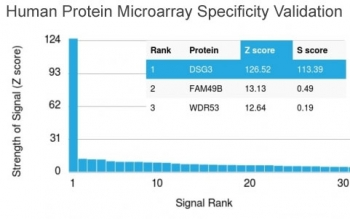 Desmoglein 3 Antibody / DSG3