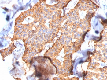 HER2 Antibody / ErbB2