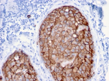 HER2 Antibody / ErbB2