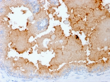 AKT1 Antibody